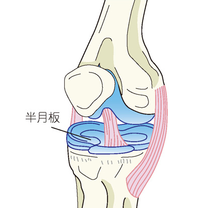 半月板