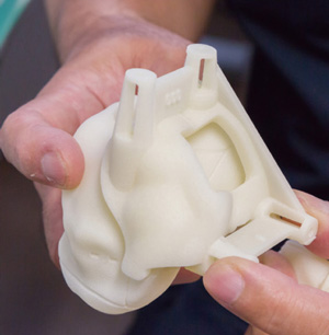 3Dプリンターで作成した膝関節の模型